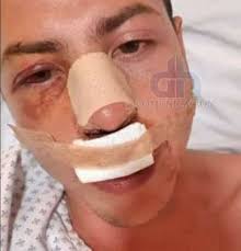 Colombia 🛑LE PIDIÓ LA PRUEBITA DE AMOR 💓A LA NOVIA, Y ESTA SE LO DIJO AL  PAPÀ Y EL LO AGREDIÓ BRUTALMENTE. La pareja llevaba tres meses de relación  amorosa, pero el