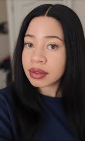 Skin care routine for albinism