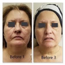 Profile for Ageless Center Indy