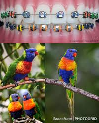 Rainbowlorikeet Lorikeet Rainbow Parrot Parrots Bird Birds Birdsofinstagram Queensland Australia Bra Cute Braces Colors Getting Braces Braces Colors