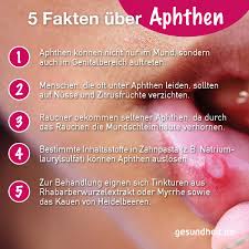 Out of 6,122,890 records in the u.s. Aphthen Schmerzhafte Blaschen Im Mund Gesundheit De