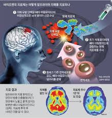 (해외기사 제목번역) fda, 바이오젠 알츠하이머 치료제 아두카누맙 승인 (1). Ejqchleeitj20m