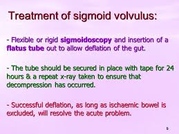 Treatment Of Acute Large Bowel Obstruction 1 Large Bowel Obstruction Is Caused By Carcinoma Or Carcinoma Or Diverticular Disease Diverticular Disease Ppt Download
