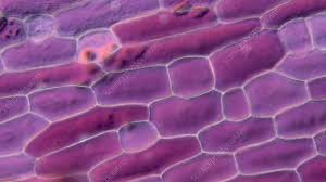 #orchid #plant #microscope #plant cells #my photos. Plant Cell Plasmolysis Light Microscopy Stock Video Clip K009 3986 Science Photo Library
