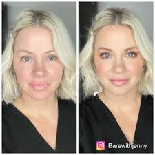 What skin issues do you battle?