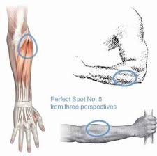 Pin On Elbow