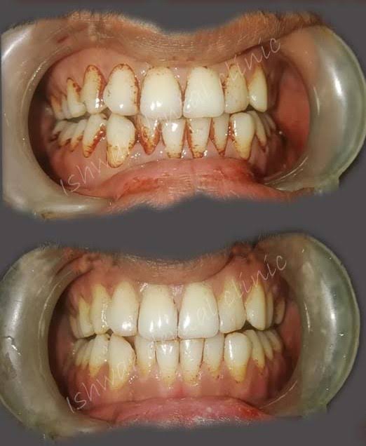Revitalize Your Smile with Expert Dental Cleaning. product image