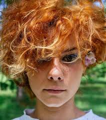 Hydrogen peroxide is commonly used to lighten hair. How To Fix Orange Hair After Bleaching 6 Quick Tips