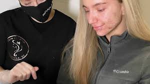 Best Skin Lightening Treatments near me in Preston