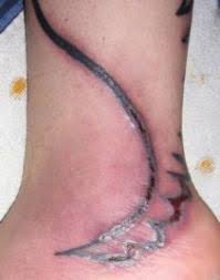 Causes, symptoms, treatment canker sores. How To Treat A Tattoo Infection Hubpages