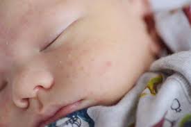 Kekalkan pipi gebu si manja dan kelembapan jari jemarinya dengan losyen yang lembut ini. Baby Comel Jangan Ambil Mudah Penjagaan Kulit Bayi