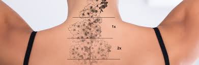 This is the safest and most desired tattoo removal approach with minimal side effects. Tattoo Removal In Mumbai Laser Tattoo Removal Cost In Mumbai