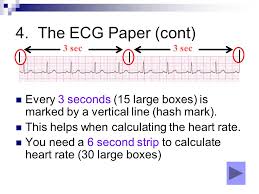 Maybe you would like to learn more about one of these? Basic Overview Ecg Rhythm Interpretation Ppt Video Online Download