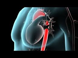 Anatomy of the Aorta - YouTube