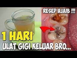 Pin Oleh Lidia Di Wew Kesehatan Gigi Obat Alami Kesehatan Alternatif