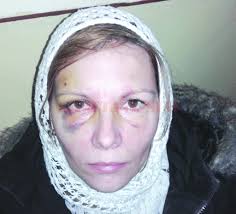 Maybe you would like to learn more about one of these? Povestea Unei Femei Abuzate Timp De 13 Ani Gazeta De Sud