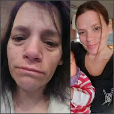 MY LIFE WITH MULTIPLE SCLEROSIS (MS) USED TO HAVE A DOCTOR