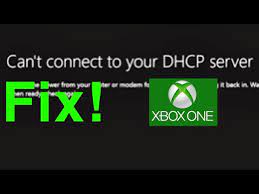 Xbox One Can't Connect To Your Dhcp Server Fix! - Youtube