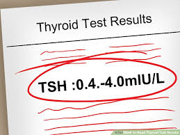 how to read and understand thyroid test results expert guide