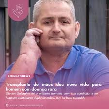 Transplante de mãos deu nova vida para homem com doença rara