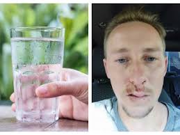 FOTO Adam vypil v horúčave studenú vodu: Takú hrôzu nečakal, nikdy to  neurobte!