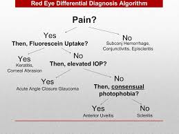 Image result for Acute Red Eye