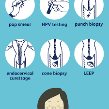 If these changes are found and treated, cervical cancer can be prevented. How Cervical Cancer Is Diagnosed