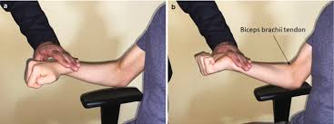 Image result for Elbow Extension Test