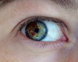 Turn Brown Eyes Blue Rare Eyes Eye Color Change Rare Eye Colors