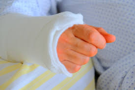 Fratura de punho: como é a recuperação? - Dra Marina Pisani