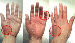 نلتقي تسلط صينية كيف اعرف ارتفاع الضغط بدون جهاز clubhouseatspringvalley com