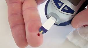 Zuckerkrankheit Typ 1 Diabetes Mellitus 1