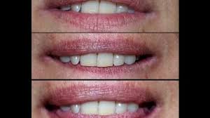 El Labio Sano T 6 Youtube