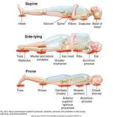 Fishbone Diagram Pressure Ulcer Google Search Wound Care Nursing Physical Assessment Nursing Study