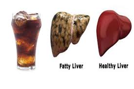 Find Out The 22 Ways Sodas Shortens Our Lives Beautyzoomin Soda Health Healthy Liver Fatty Liver