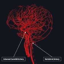 Common carotid arterythe right common carotid artery is a branch of the brachiocephalic artery.it begins in the neck behind the right sternoclavicular joint. Blood Supply To The Brain Complete Anatomy
