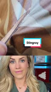 How to Remove A Stingray Barb from The Ray