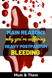 Pin On Postpartum Recovery