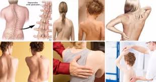 ‫رسالة ماجستير تناقش "علاج انحرافات القوام لدى المعاقين ذهنيا" بجامعة حلوان  - اليوم السابع‬‎