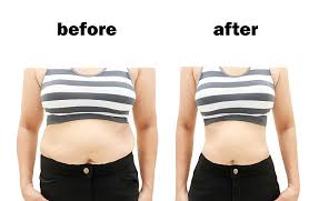 1,321 Before And After Weight Loss Stock Photos, Pictures & Royalty-Free  Images - iStock