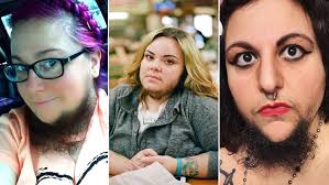 This type of beard was brought forward by eric bandholz after he got fed up with the stigma against facial hair in corporate offices. Women With Pcos Explain Why They Celebrate Their Facial Hair Allure