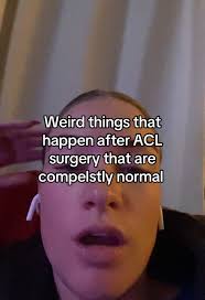 Understanding Normal Post-ACL Surgery Symptoms