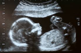 The cancer can develop from abnormal cells in the lining of the uterus (endometrium) or the muscle tissue. In Rare Cases Cancer Can Pass From Mother To Unborn Child Discover Magazine