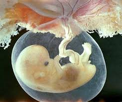 Relying solely on cervical discharge is not an accurate way to determine if you're pregnant. 7 Weeks Pregnant Might Be Some Mucus