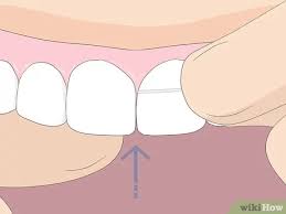In addition to regular brushing and flossing, these best practices are a good way to help you keep your pearly white teeth shining bright. How To Floss 14 Steps With Pictures Wikihow