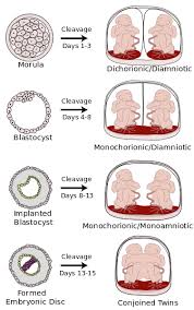 All Twins Are Not Equal Midwifery Student Midwifery Types Of Twins