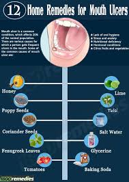 Home Remedies For Mouth Ulcers If You Are Suffering From Mouth Ulcer Then You Will Not Be Able To Enjoy Even The Most Ulcer Remedies Mouth Mouth Ulcers Ulcers