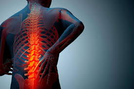 Osteoporoza zdjęcie 2