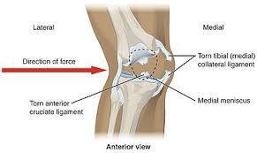 The ligaments around the knee are strong. Knee Wikipedia