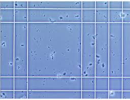 Manual Cell Counting V S Automated Cell Counting